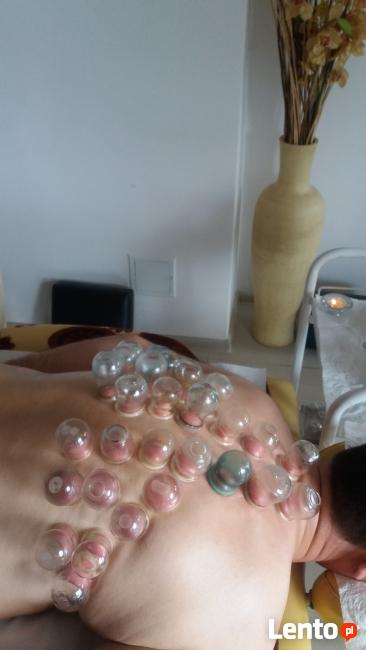 Kurs - Terapie bańkami ogniowymi i bezogniowymi