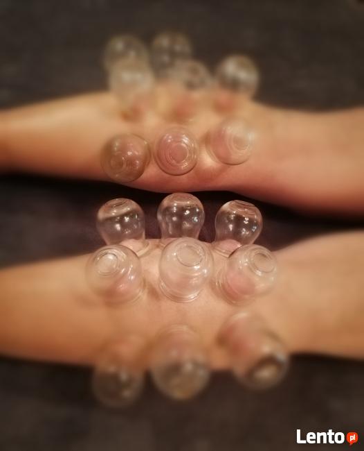 Kurs - Terapie bańkami ogniowymi i bezogniowymi