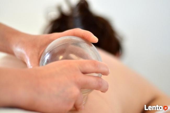 Stawianie baniek lekarskich