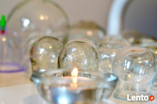 Stawianie baniek lekarskich