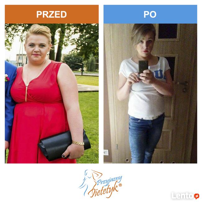 Dietetyk Człuchów. Indywidualny Plan Żywieniowy