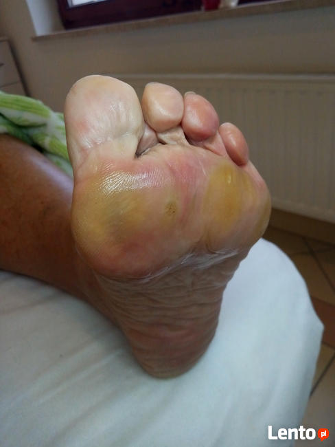 Podolog Bochnia - zdrowe stopy