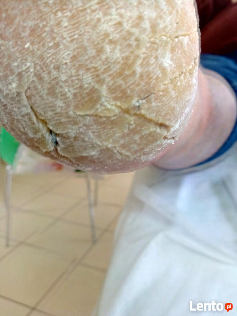 Podolog Bochnia - zdrowe stopy