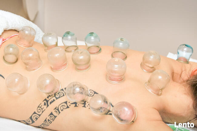 AKUPUNKTURA leczenie BÓLU, MIGREN, ZATOK, NAŁOGI, ODCHUDZANI