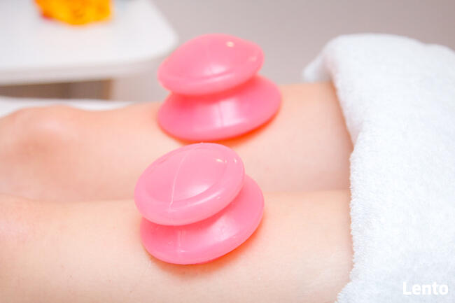 AKUPUNKTURA 140zł Usprawnianie płodności, bóle, rwą kulszowa