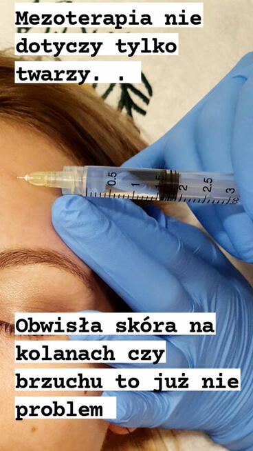 OSOCZE bogatopłytkowe.