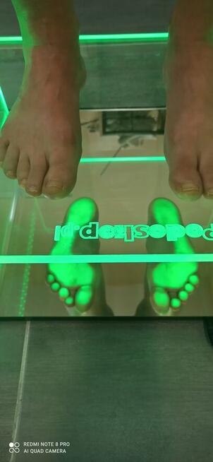 Indywidualne wkładki ortopedyczne