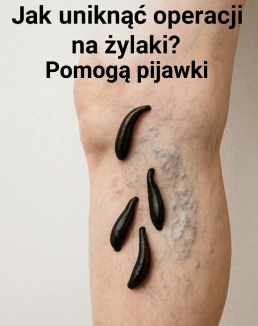 Terapie naturalne:pijawki, masaże, tlenoterapia w komorze jip