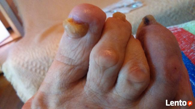 Leczniczy pedicure dla seniorów, kosmetyczny, manicure