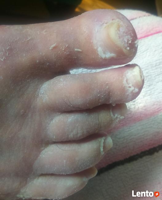 Leczniczy pedicure dla seniorów, kosmetyczny, manicure