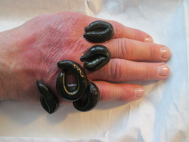 Hirudoterapia Leczenie pijawkami Jarocin Pleszew Ostrów Wlkp