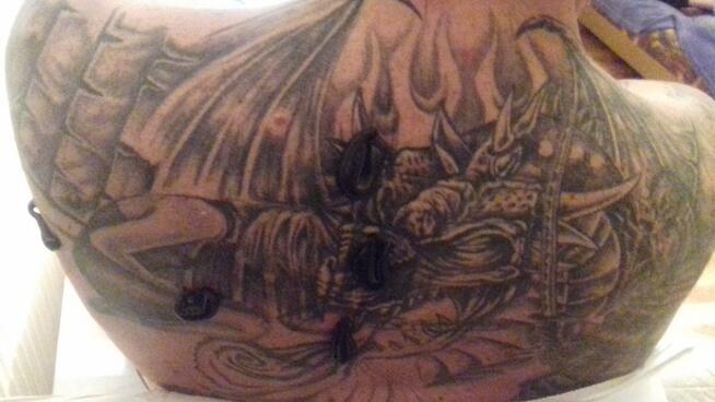 Hirudoterapia Leczenie pijawkami Jarocin Pleszew Ostrów Wlkp