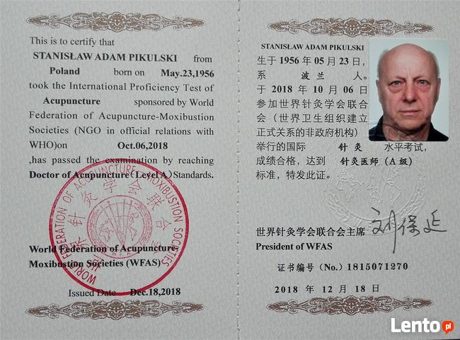 AKUPUNKTURA I MOKSOTERAPIA