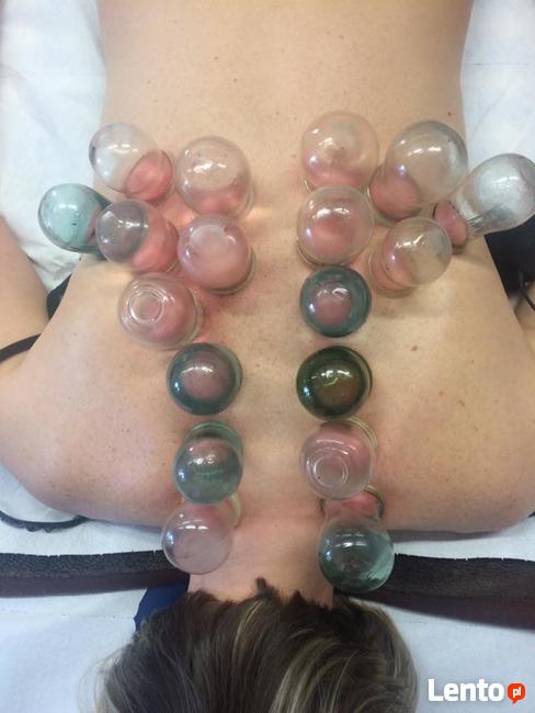 Kurs - Terapie bańkami ogniowymi i bezogniowymi