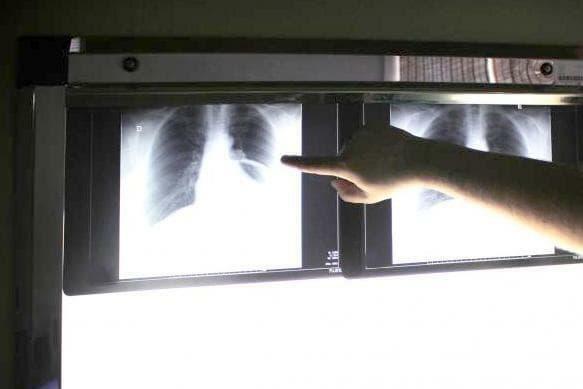 Ochrona radiologiczna pacjenta - online