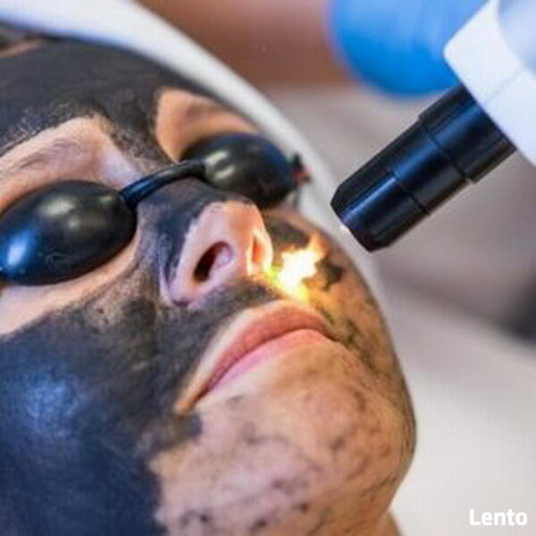 Laserowy Peeling Węglowy Black Doll Odmładzanie Stymulacja