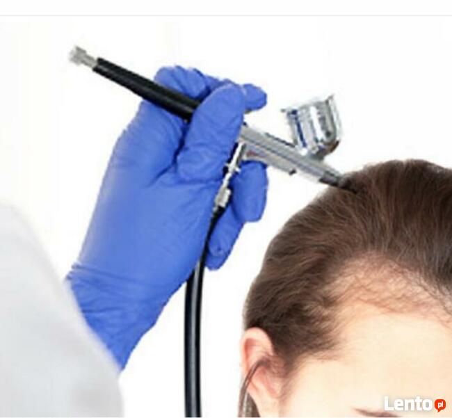 Trycholog łysienie łupież łojotok