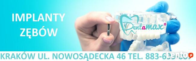 Implanty zębów Kraków Kurdwanów - Dentamax Nowosądecka 46