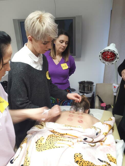 Stawianie Baniek Lekarskich z Dojazdem. Warszawa. Od 150 zł