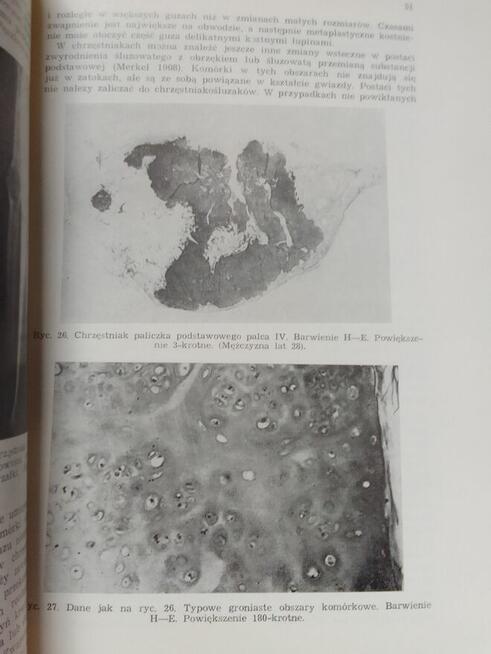 G.W. Dominik, H.G. Knoch Nowotwory i guzopodobne choroby ko