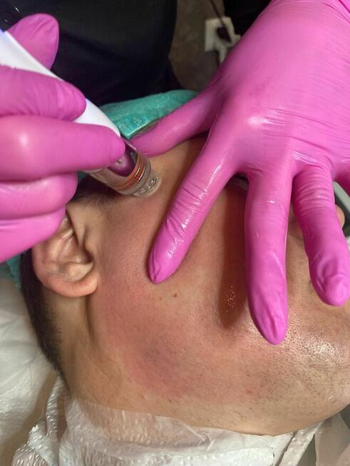 Zabiegi kosmetyczne PROMOCJA!!!