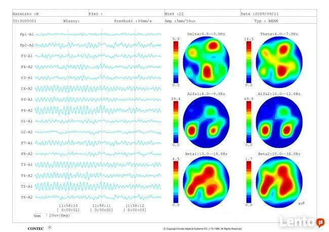 Badanie EEG - Elektroencefalografia