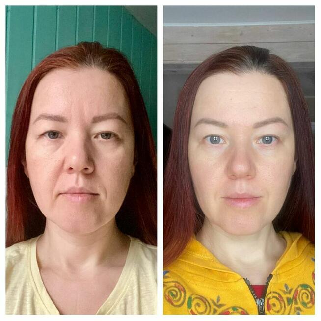 Naturalne odmładzanie – zadbaj o swoją urodę bez chemii!