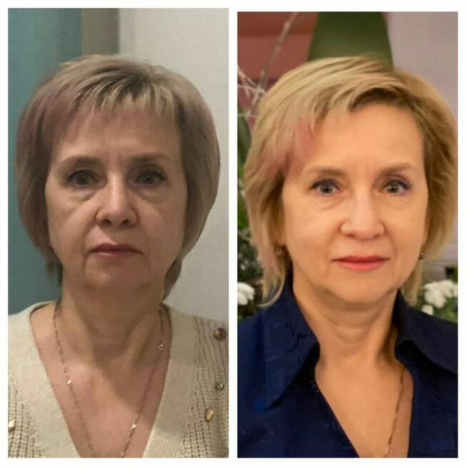 Naturalne odmładzanie – zadbaj o swoją urodę bez chemii!