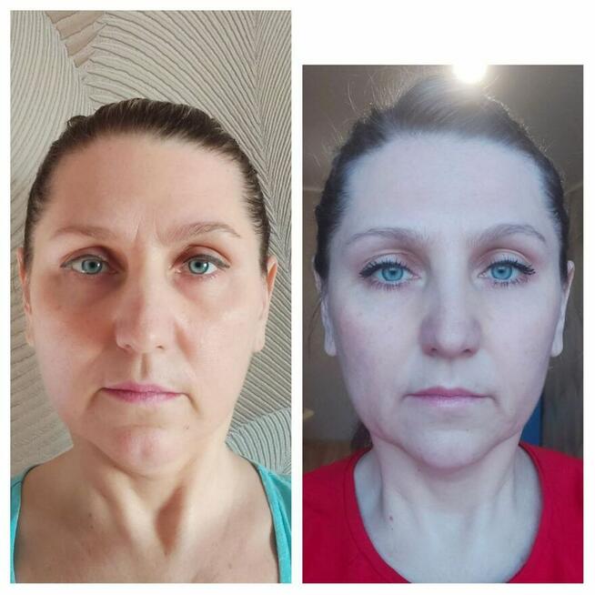 Naturalne odmładzanie – zadbaj o swoją urodę bez chemii!