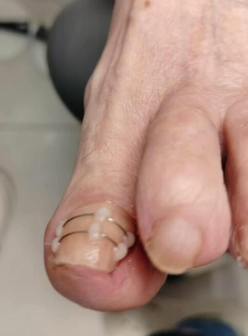 Podologia Warkocki , ortopodologia