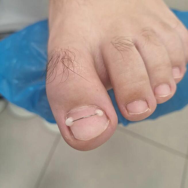 Podologia Warkocki , ortopodologia