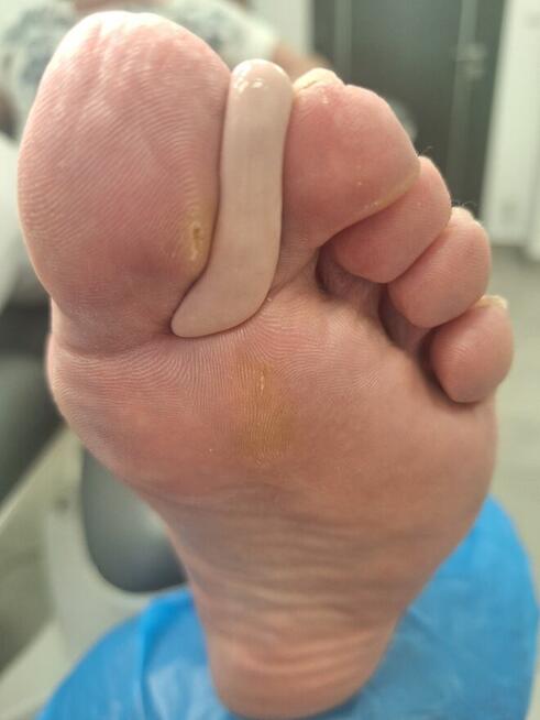 Podologia Warkocki , ortopodologia