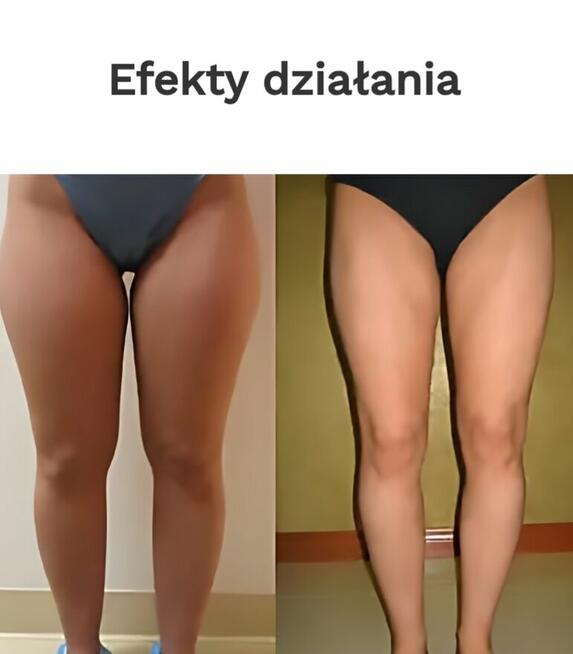 “Szybka sylwetka na lato – EMSlim Pro + promocja!”