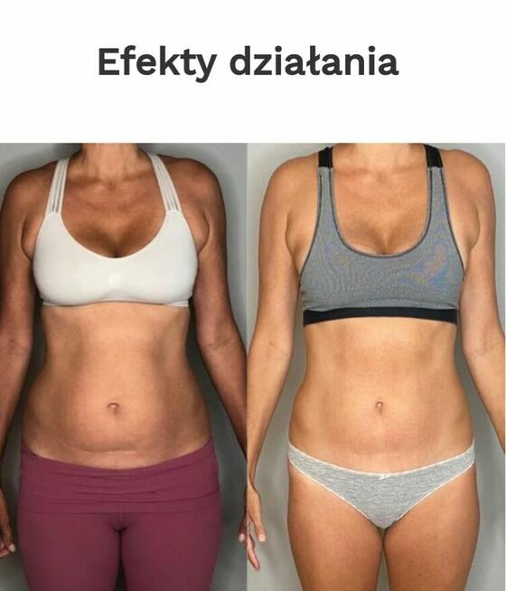 “Szybka sylwetka na lato – EMSlim Pro + promocja!”