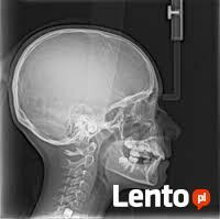 Pantomografia .RTG zebów, 3D