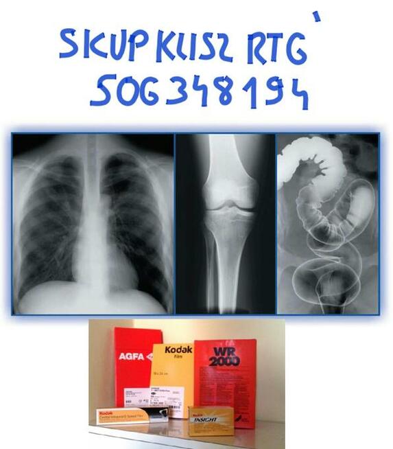 SKUP KLISZ, BŁON,ZDIĘC RENTGENOWSKICH.RTG.tel.506-348-194