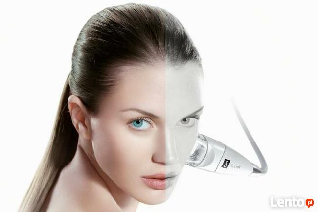 Endermologia, Endermolift