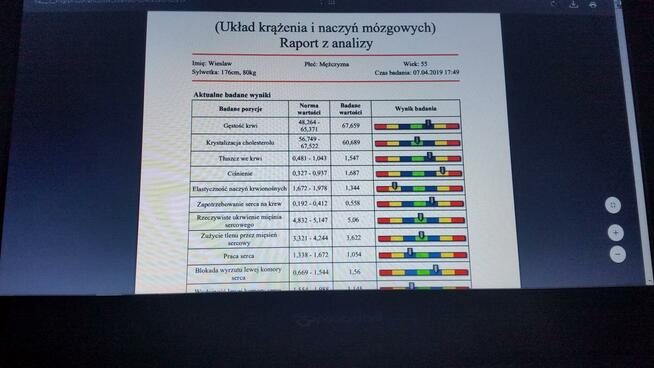 Biorezonans, skan organizmu, niedobory, witaminy, alergie itp