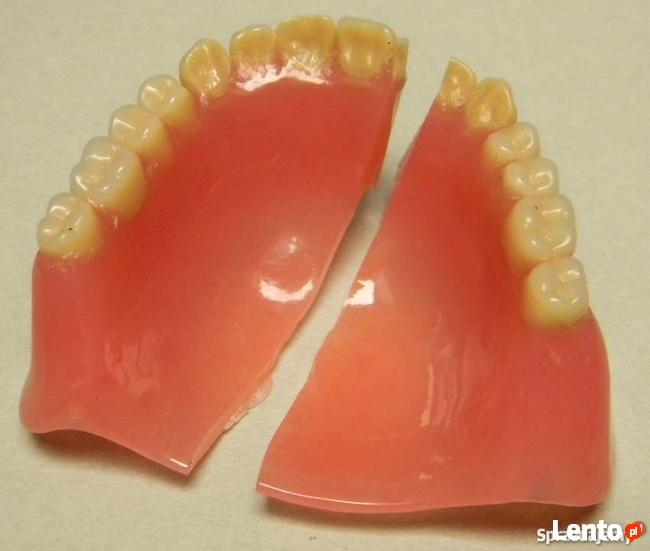 Naprawa szczęk protez protetyka zębowa rzeszów ekspres