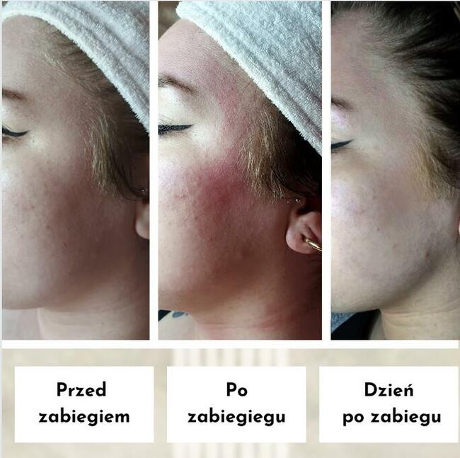 Paznokcie/Brwi/Rzęsy/Oczyszczanie twarzy/ Zabiegi