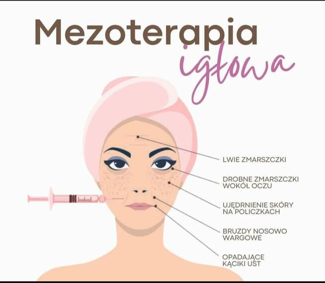 Mezoterapia igłowa