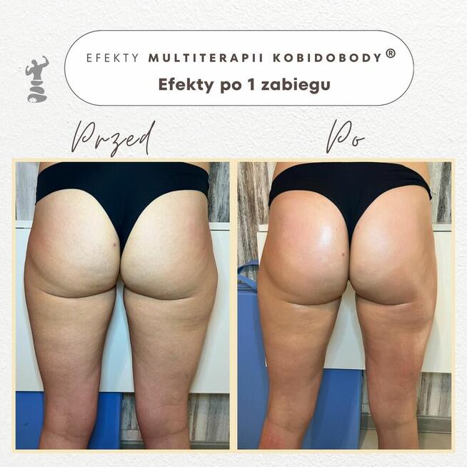 PROFESJONALNE KURSY SZKOLENIA KOBIDO KORUGI KOBIDO BODY