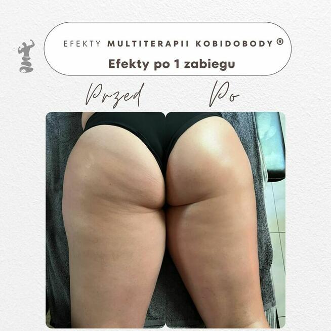 PROFESJONALNE KURSY SZKOLENIA KOBIDO KORUGI KOBIDO BODY