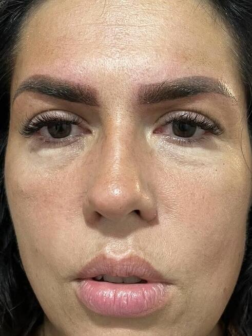 Szkolenie pmu Lips 3 dni Basic