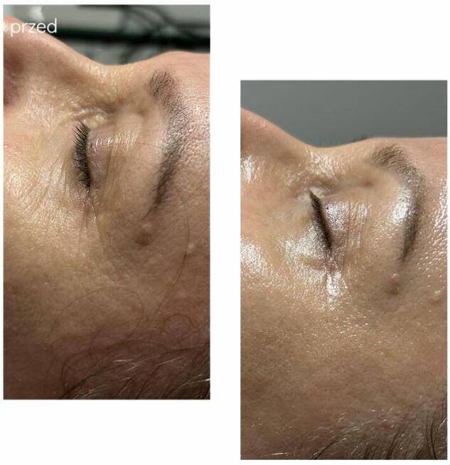 Masaże, Sauna, zajęcia ruchowe, kosmetyczka, Vouchery,