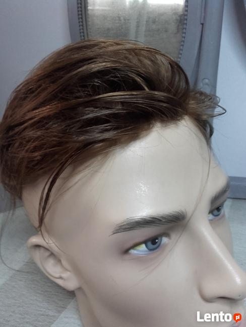 Niechirurgiczne uzupełnianie włosów - rekonstrukcja włosów