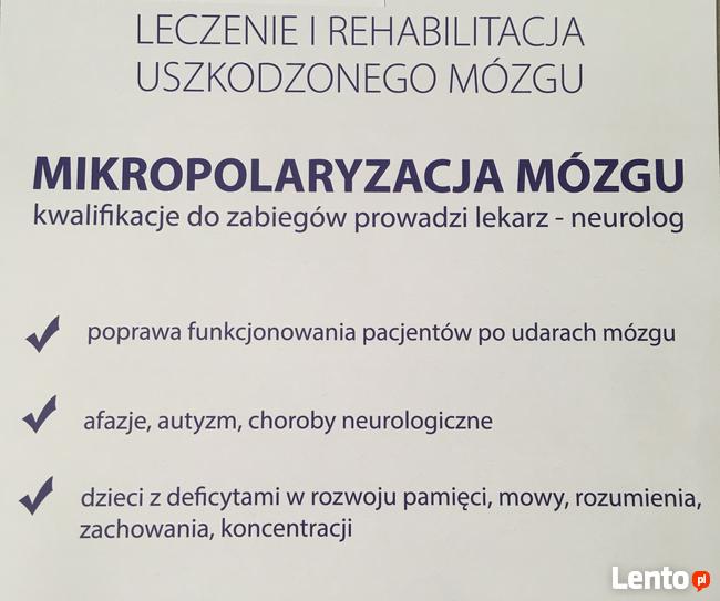 Mikropolaryzacja Mózgu