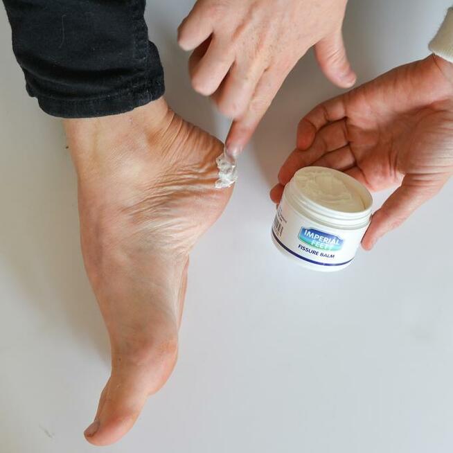 Chemioterapia podologia wrastające i wkręcające paznokcie