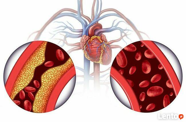 Klinika Chelatacji Warszawa