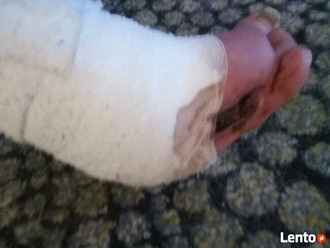 Michałowi grozi amputacja! Pomóż! Pilnie potrzebna pomoc